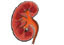 kidney project